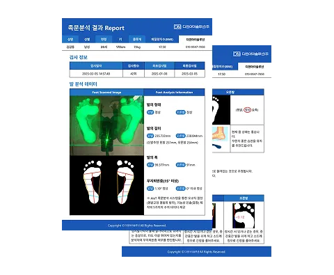 AI 족문분석 결과를 정리한 디지털 족문 분석 리포트 예시